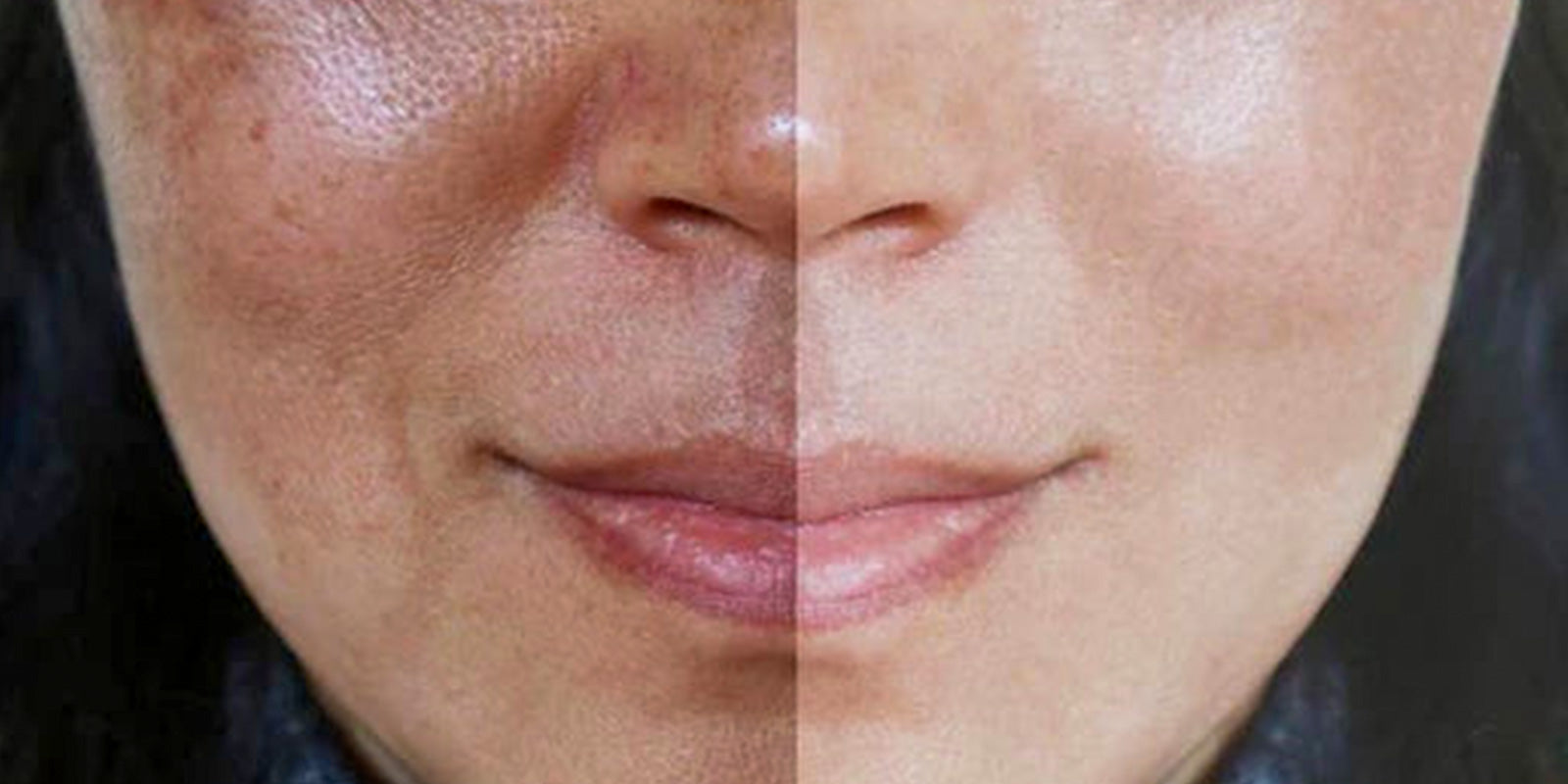 Comment réduire les taches brunes sur le visage