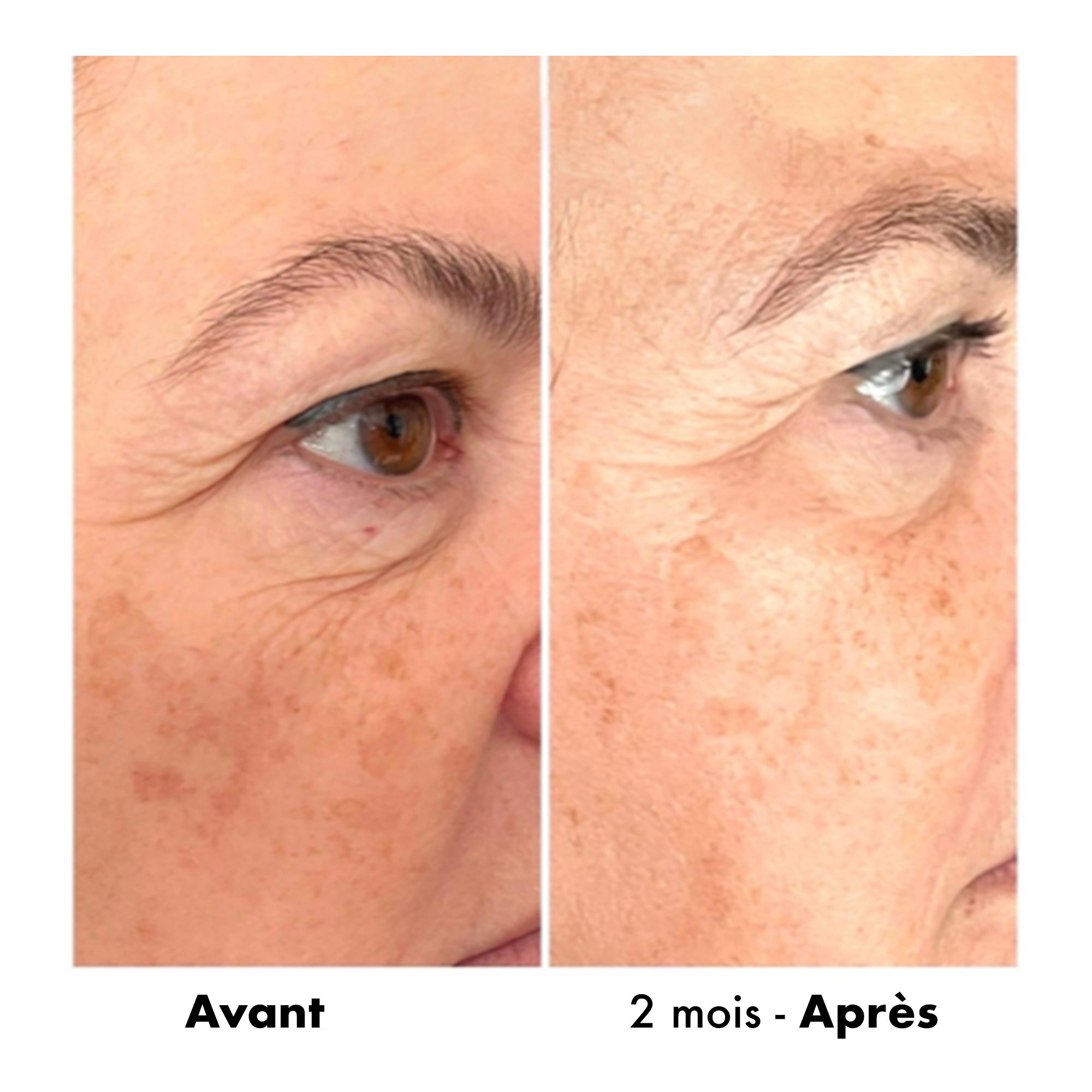 Avant-Apres Raffermissement