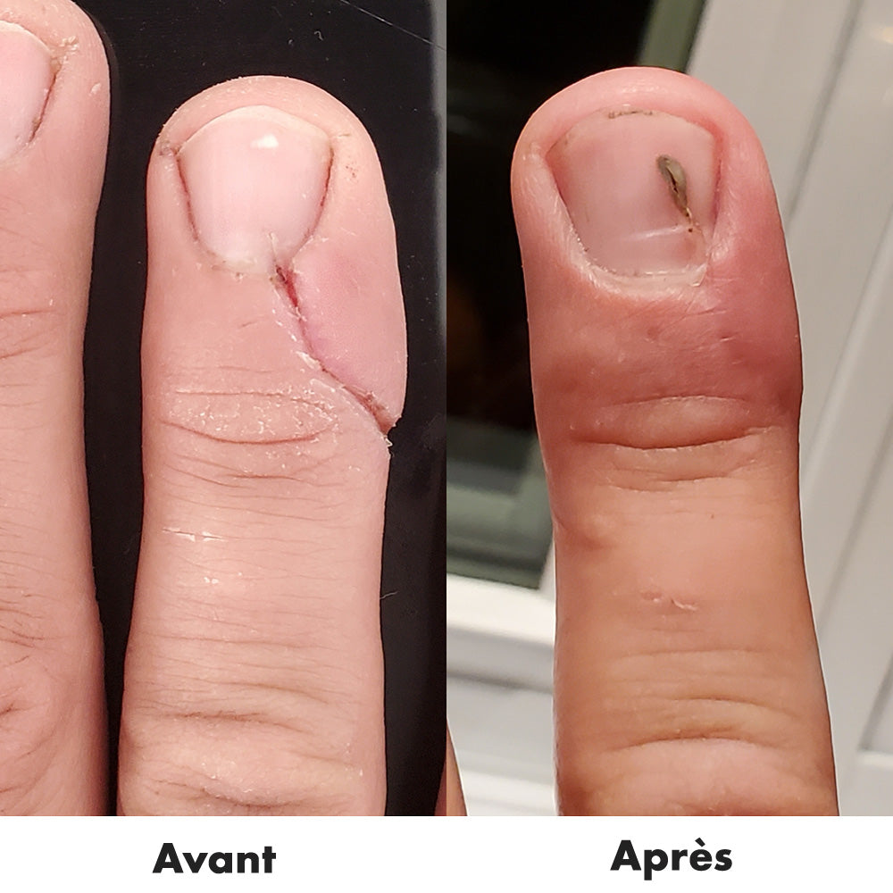 https://rdcosmetic.com/blogs/blogue/comment-cicatriser-une-plaie-profonde